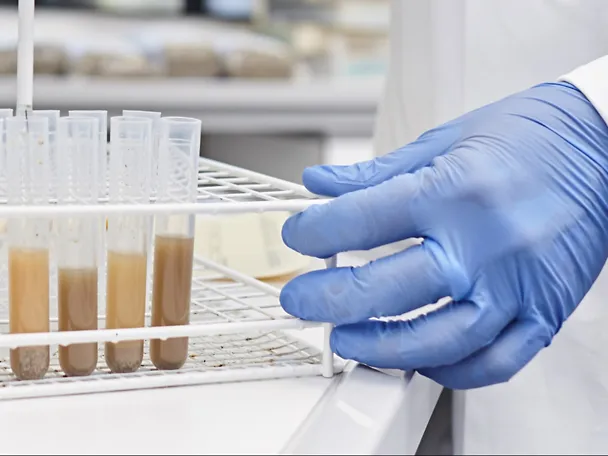 Proben werden im Labor der ISF untersucht